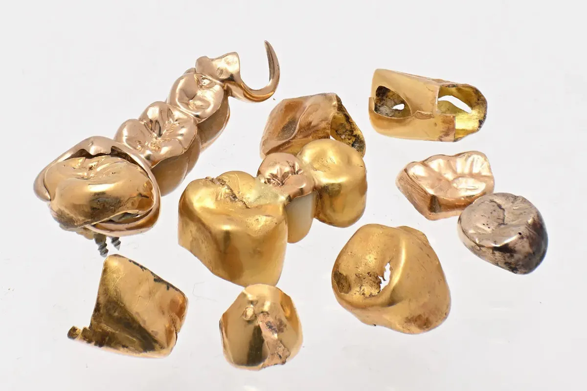 買取実績：歯科用金